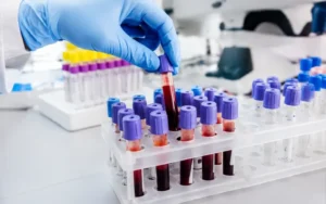 Laboratory Testing and Required Procedures